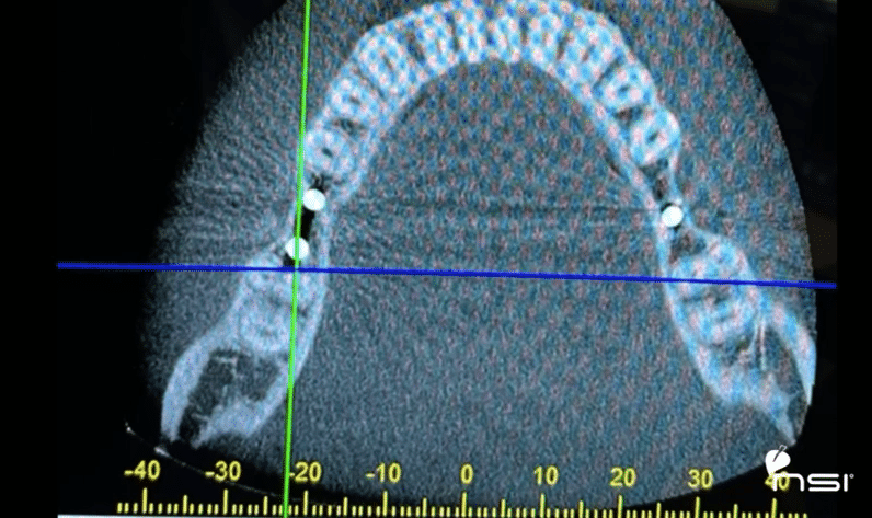 Screenshots from the Operation Video